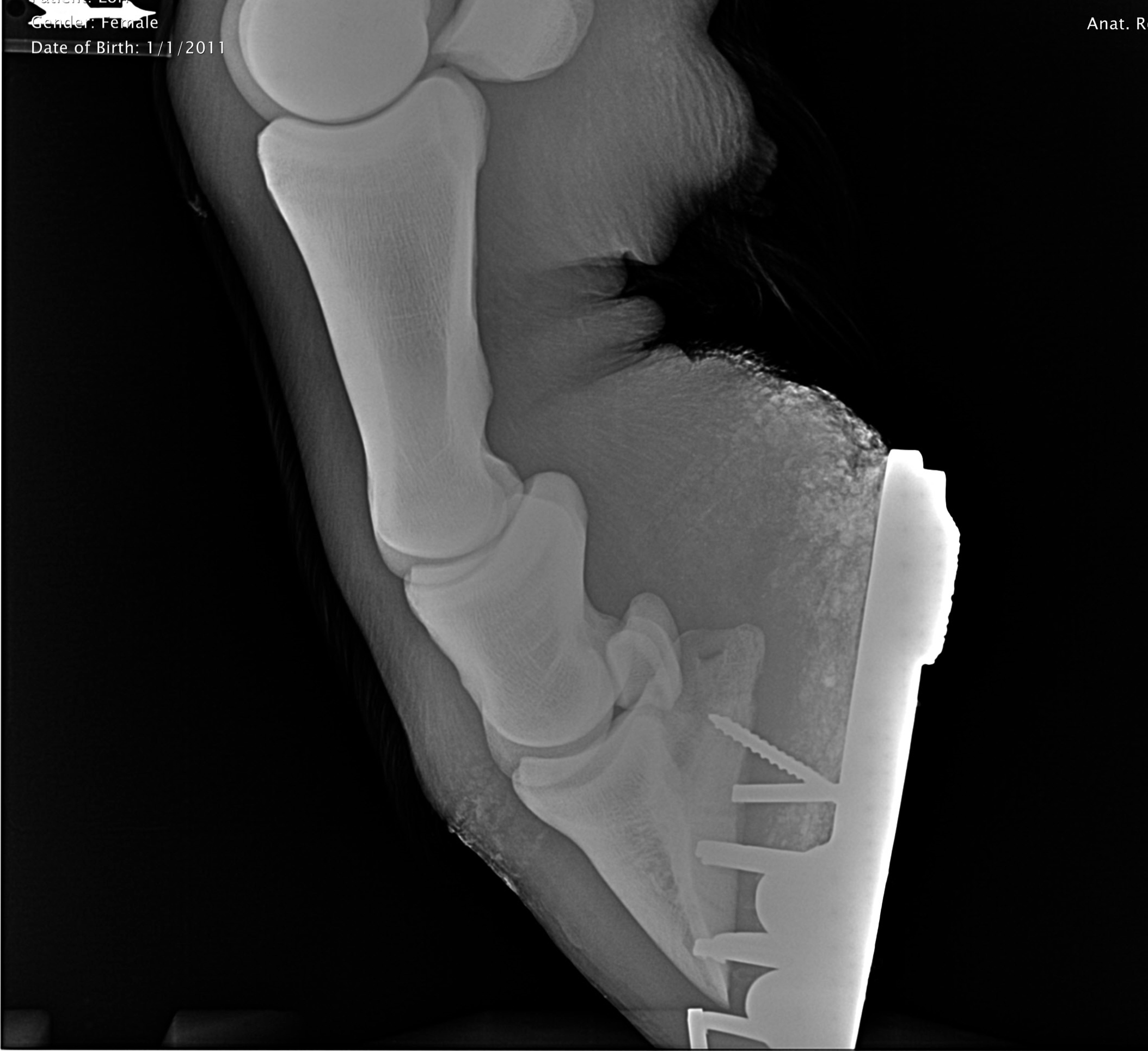 Digital Radiography Image