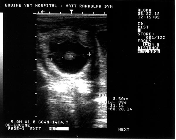 Digital Ultrasound Image